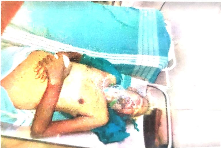 ಅನಾಮಧೇಯ ವ್ಯಕ್ತಿ ಮೃತ: ವಾರಸುದಾರರ ಪತ್ತೆಗೆ ಮುನಿರಾಬಾದ್ ಪೊಲೀಸರ ಮನವಿ